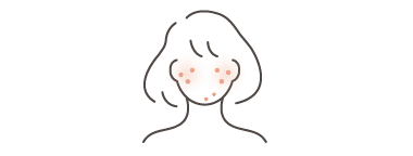 *