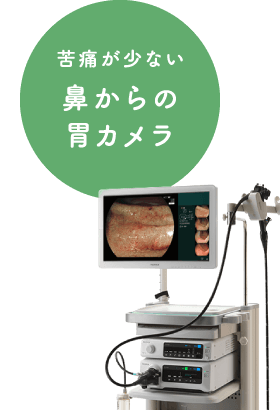 苦痛が少ない鼻からの胃カメラ